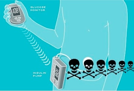  Hacking insulin pumps. Image source: https://www.extremetech.com/extreme/92054-black-hat-hacker-details-wireless-attack-on-insulin-pumps 